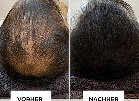 Ergebnisse einer Haarpigmentierung
